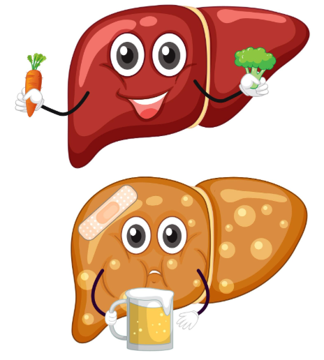 Fatty liver