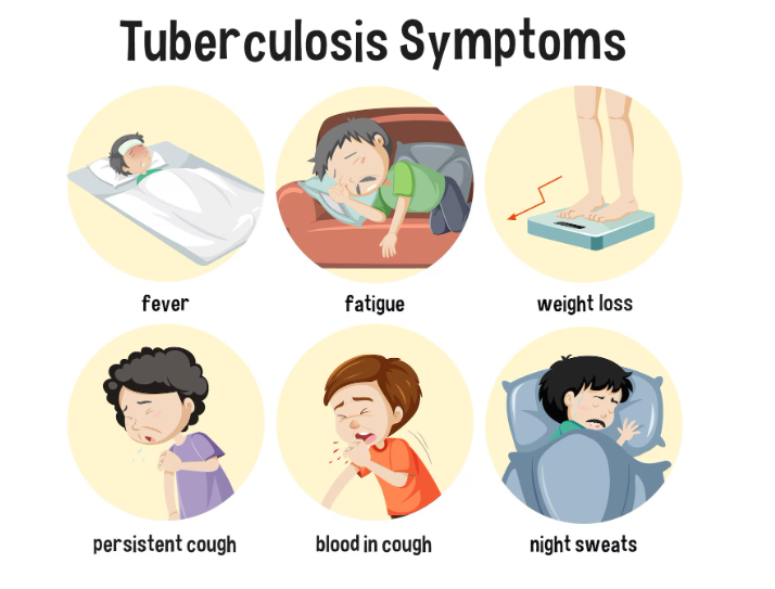 Tuberculosis
