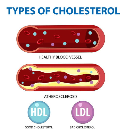 Types of Cholesterol