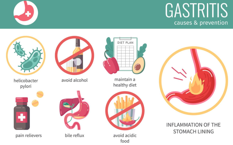 Gastric problem Causes