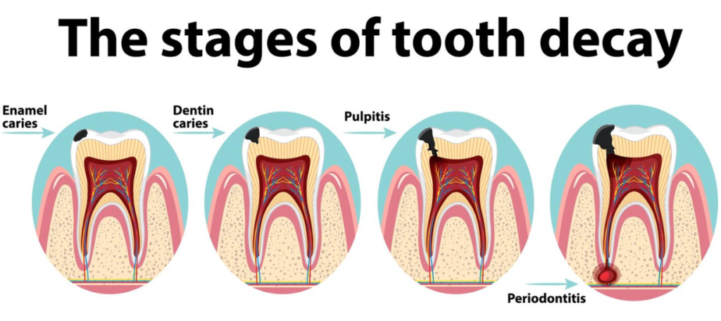 Cavity problem