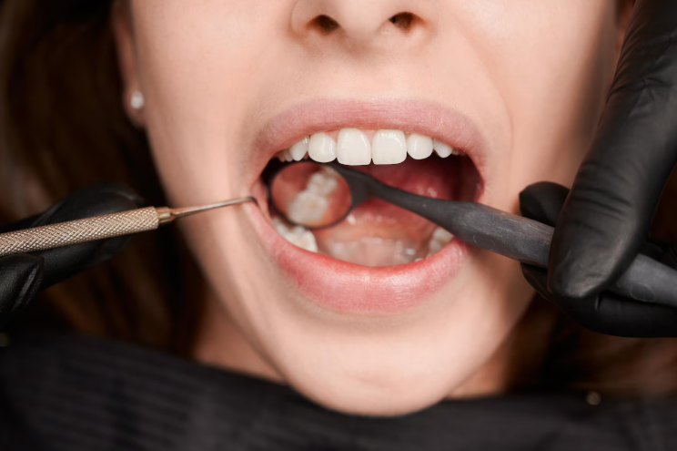 Cavity